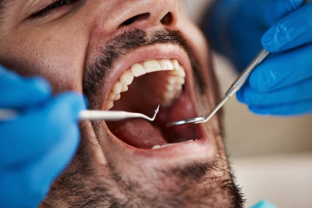 Best Dentist for Tooth Abscess  in Whitehall, MI